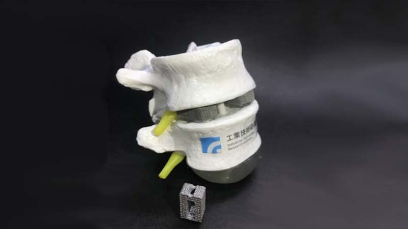 3D Printed Bones especially for Ethnically Chinese People by ITRI