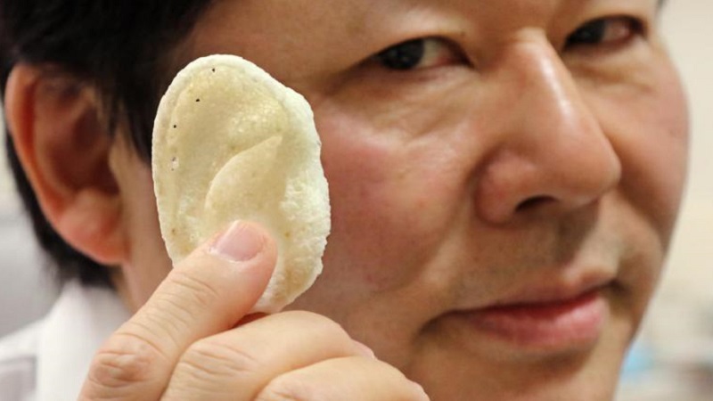 CT Bone Implants By Next 21 Gets Approved In Japan And Europe