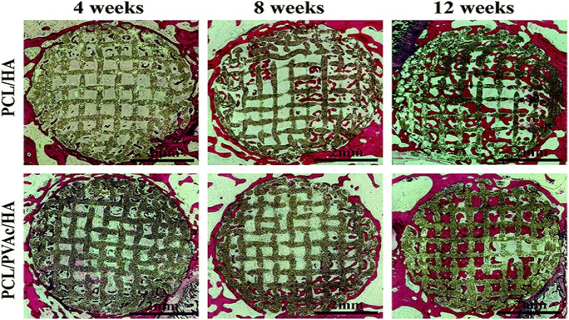 Researchers Select The Winner Scaffold For Bone Formation With 3D Printing