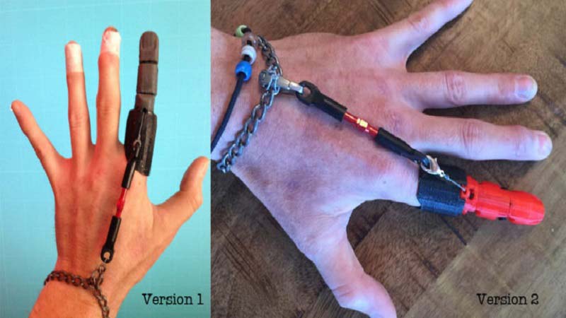 3D Printed Partial Finger Prosthetic