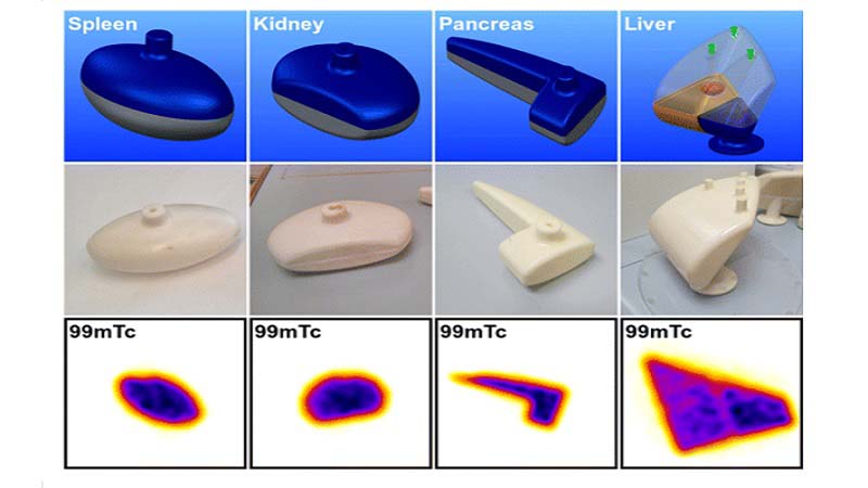 3D PRINTED PHANTOMS FOR MOLECULAR RADIOTHERAPY DOSIMETRY