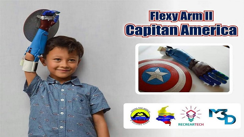 Colombia Kid receives Captain America 3D Printed Hand