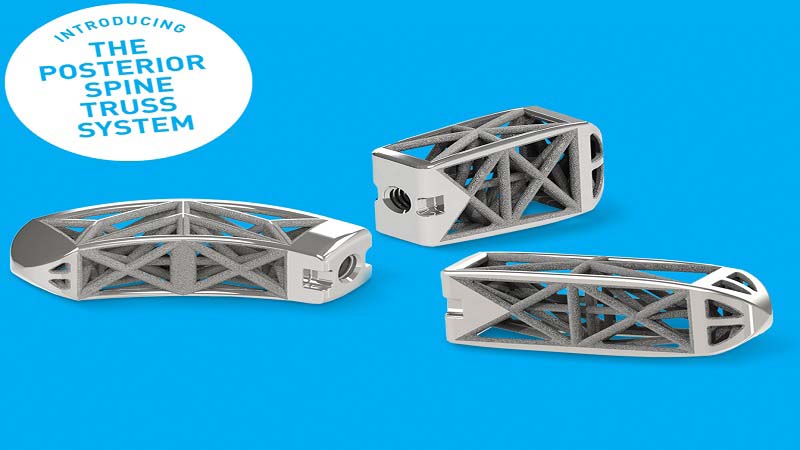 4Web launches Posterior Spine Truss