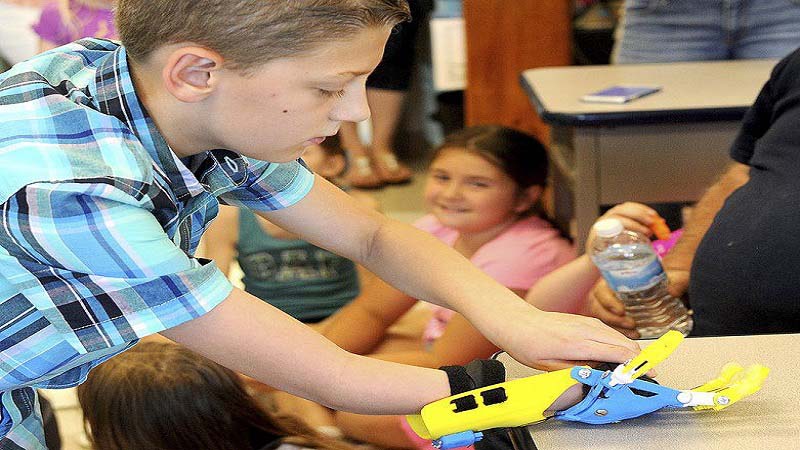3D Printed Prosthetic Hand by Kids