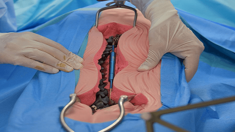 robotic spinal surgery