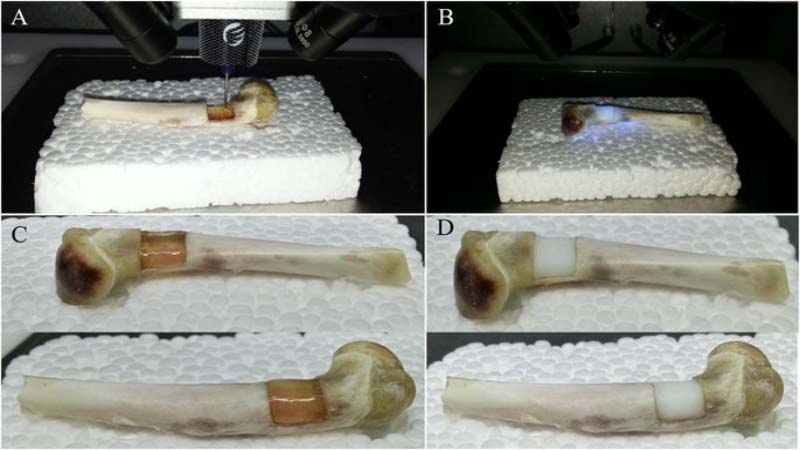 Chinese Researchers use 3D Printing to Correct Bone and Cartilage Defects