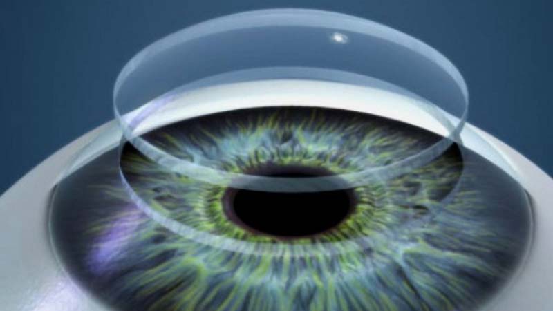 IdiPAZ Researchers in Spain pave way for 3D Printed Corneas to tackle Huge Demand of Donors