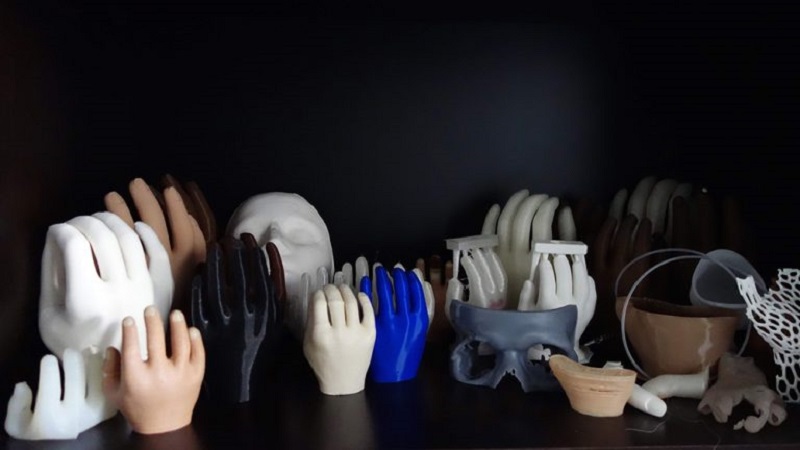 War Victims Start Receiving 3D Printed Prosthetics