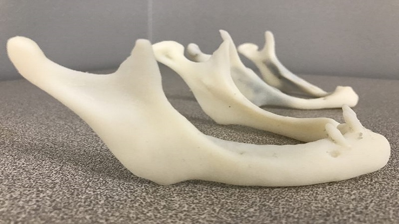 Surgeons At VA Hospital Channeling 3D Printing To Create the Ideal Mandibular Implant