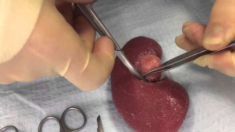 Aspect Biosystems Collaborate With Maastricht University For 3D Printed Kidney Tissue