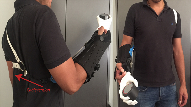 3D Printed Prosthetic With Negligible Assembly For Developing Countries
