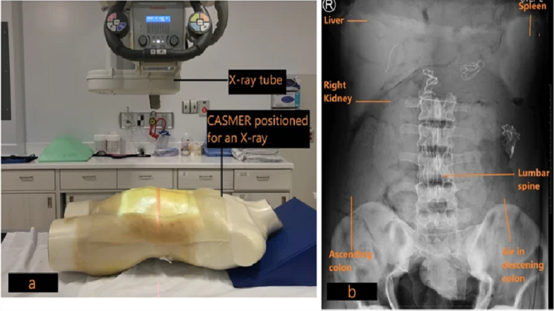 Canadian Researchers Unveil CASMER 3D Printed Anatomical Models