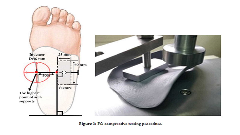Evaluating The Benefits Of 3D Printing In Flat Foot