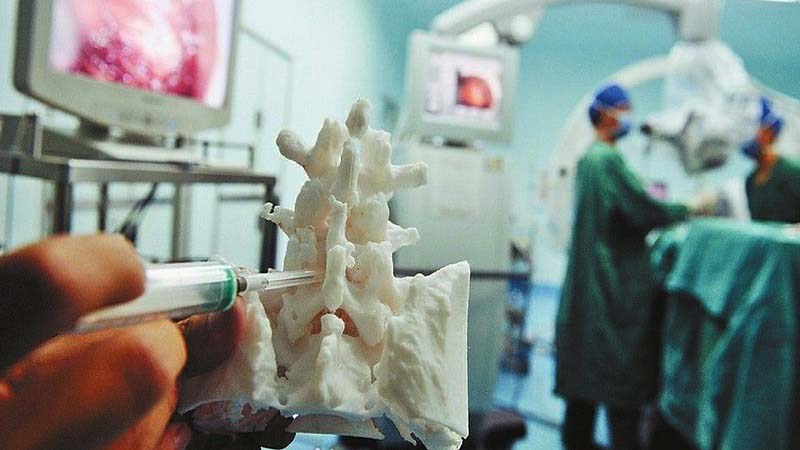 3D Print Chinese Spinal Surgery