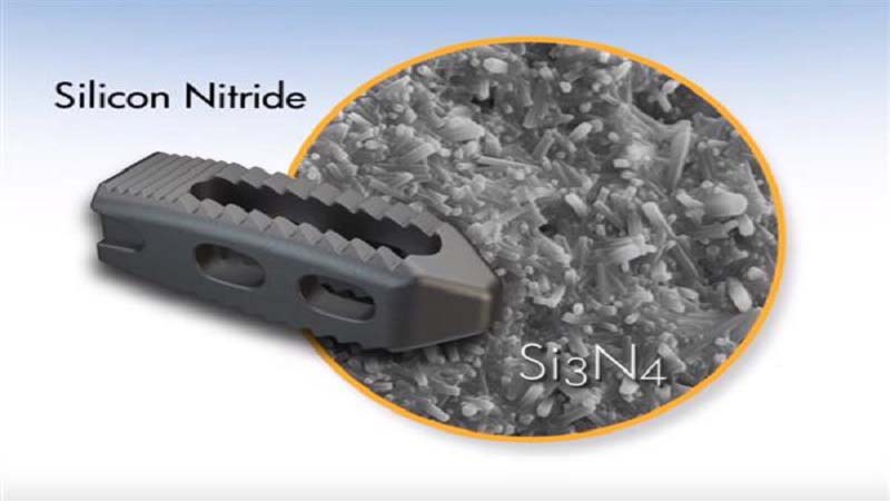 Amedica Silicon nitrate 3d print