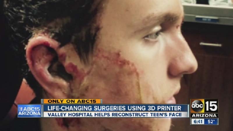 Phoenix Surgeons showcases 3D Printed Facial Reconstruction