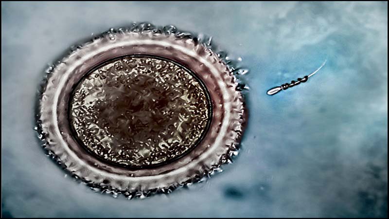 SpermBots for Male Infertility by 3D Printing
