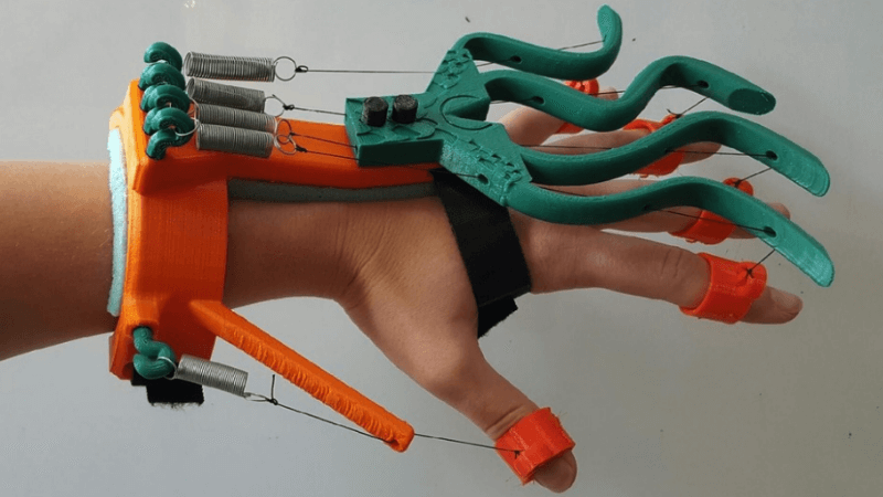 3D Printed Aquahand to Help Victims Regain Hand Movement