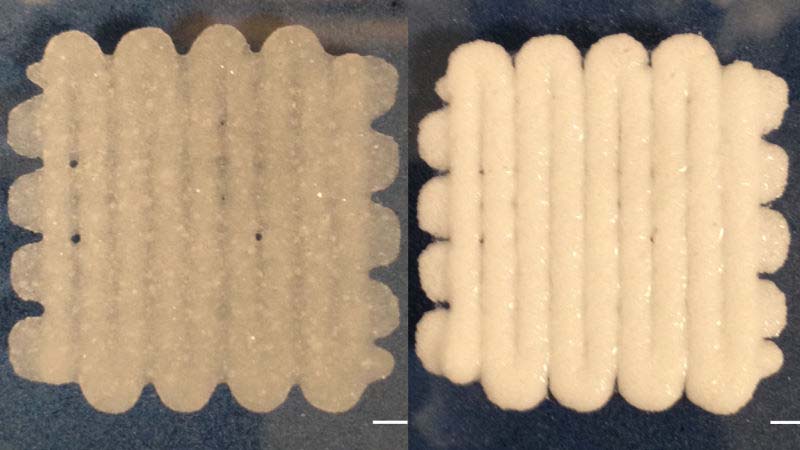 cancellous bone 800x450