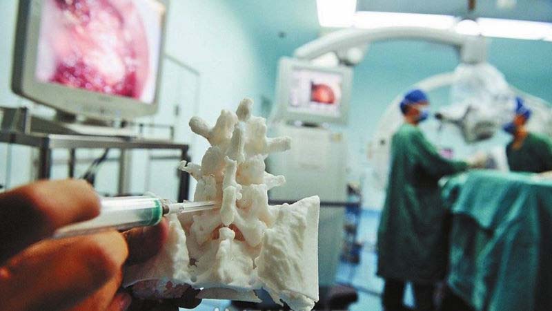 chinese spinal surgery 800x450